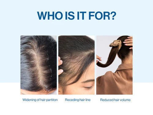 Advanced Hair Density Roll-On Serum