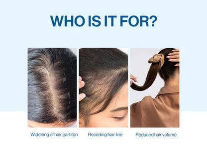 Advanced Hair Density Roll-On Serum