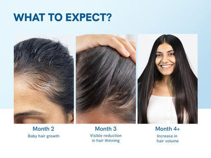 Advanced Hair Density Roll-On Serum